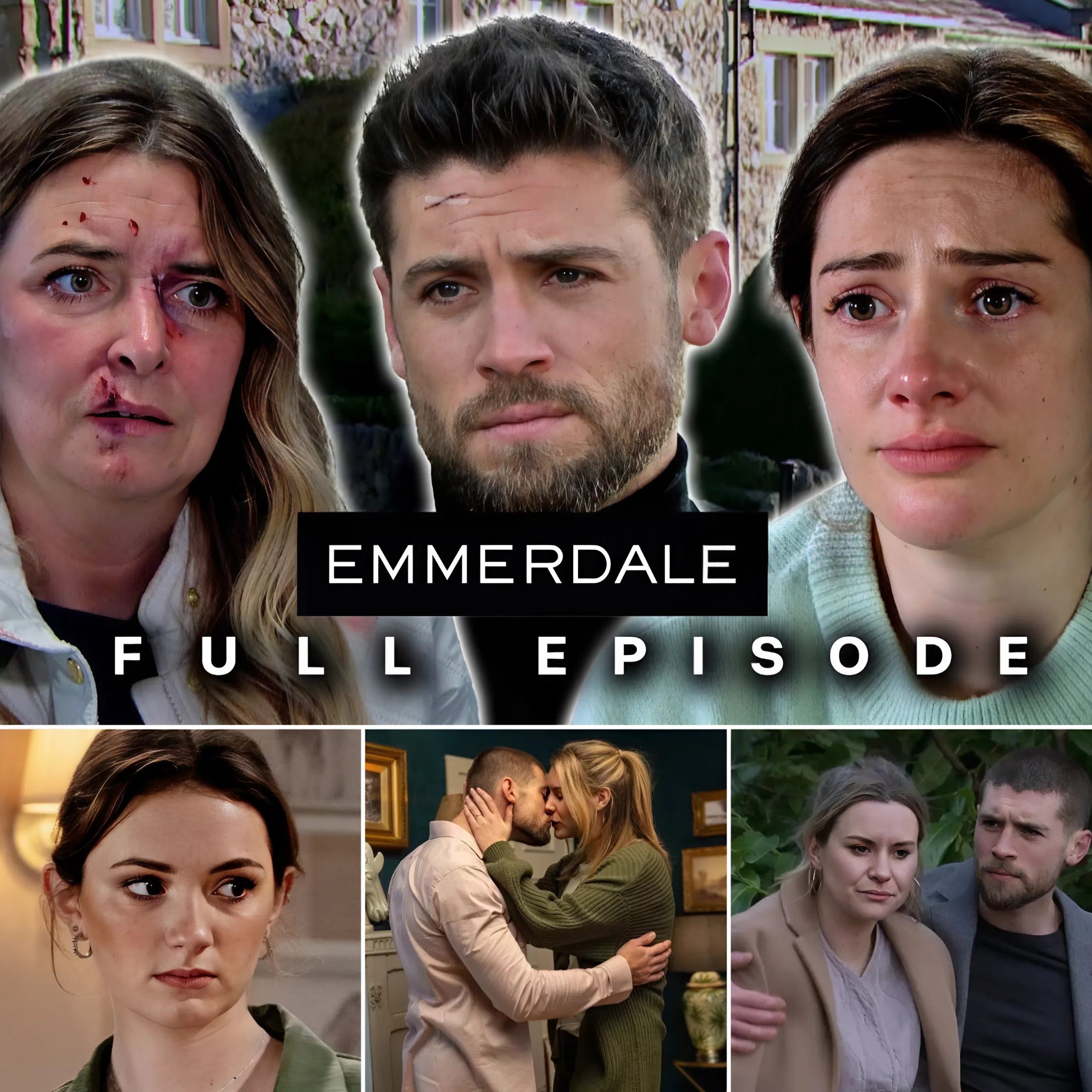 BREAKING NEWS !!Emmerdale: A bloody and tearful accident – The horrifying truth behind John Sugden’s death.